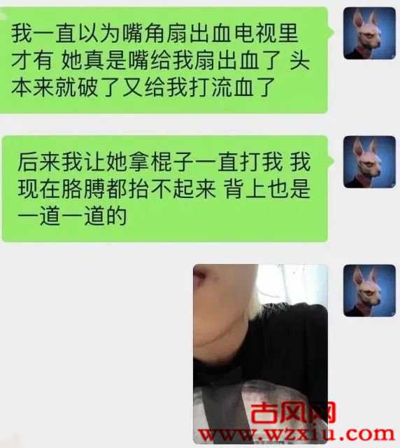 抖音400W混血网红卓宝疑似家暴？下体被塞5个烟头