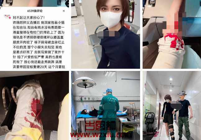 晓亮新女友宇霸霸怀孕？豆姐有s密视频曝光三根绳？时大漂亮受伤缝10针