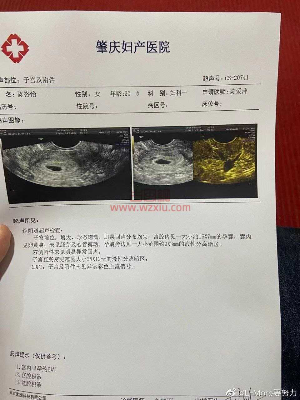 吃瓜!肇庆学院陈格怡事件是什么梗?